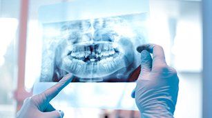 Dental Exam — Tooth X-ray Result in Redding, CA Dental Exam — Tooth X-ray Result in Redding, CA