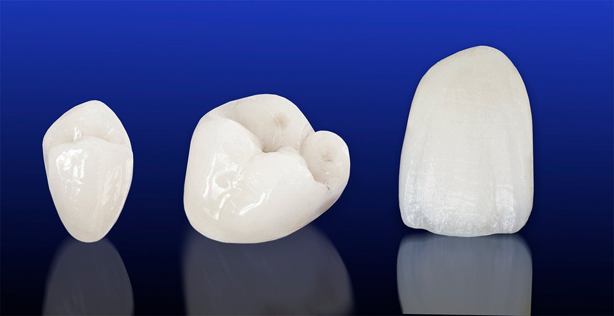 Porcelain Crowns &  Bridges