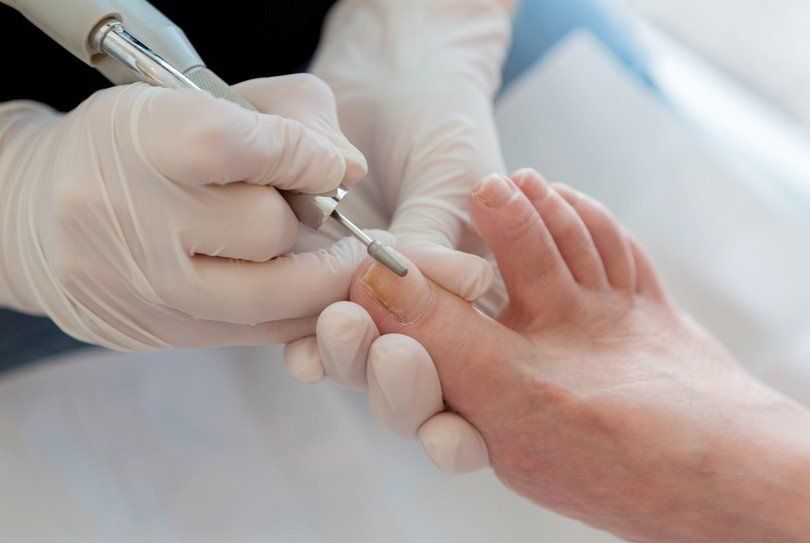 Een pedicure verzorgt de nagels niet alleen door knippen maar ook door ze te frezen