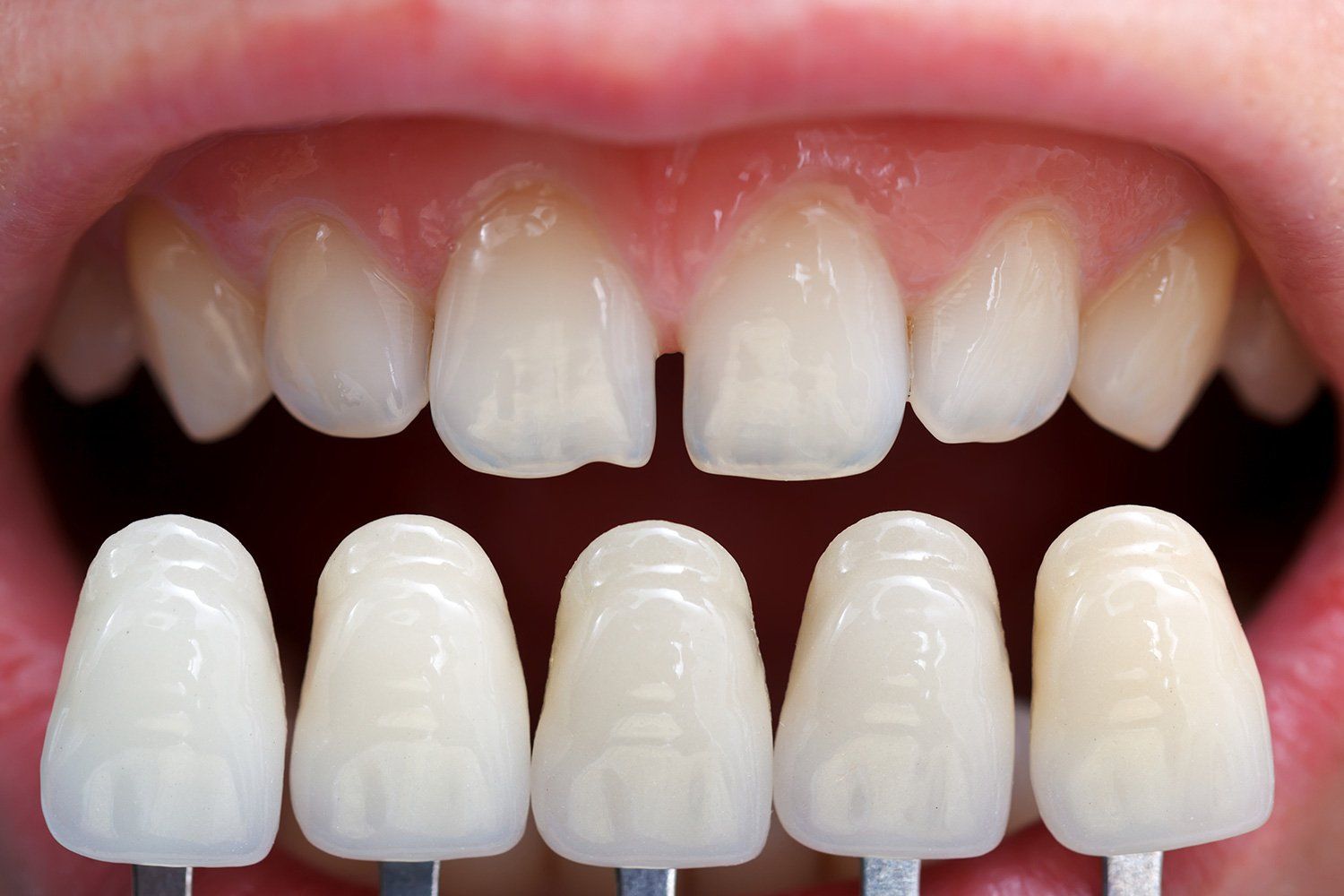 Odontoiatria Estetica: Studio Dentistico Vecchiotti Marco Cesena
