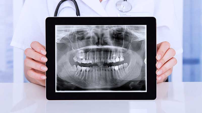 Radiografia digitale: Studio Dentistico Vecchiotti Cesena 0547 24741