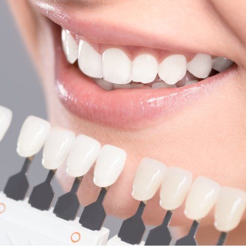comparing patient teeth with the samples