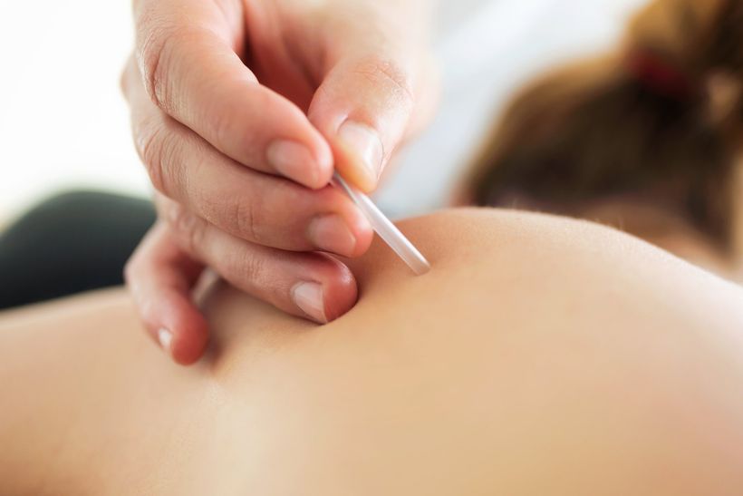 Acupuncture
