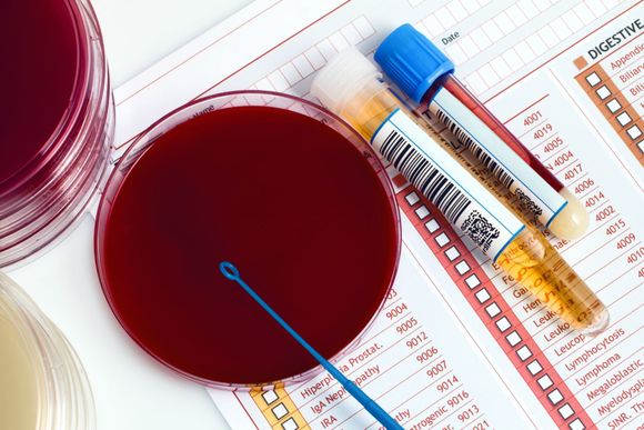 analisi microbiologiche