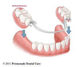 Cosmetic Dentist in Anderson, SC