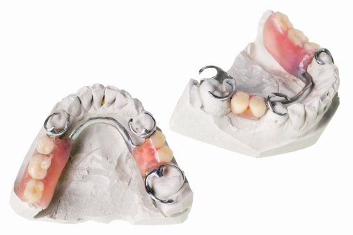 Cosmetic Dentist in Anderson, SC