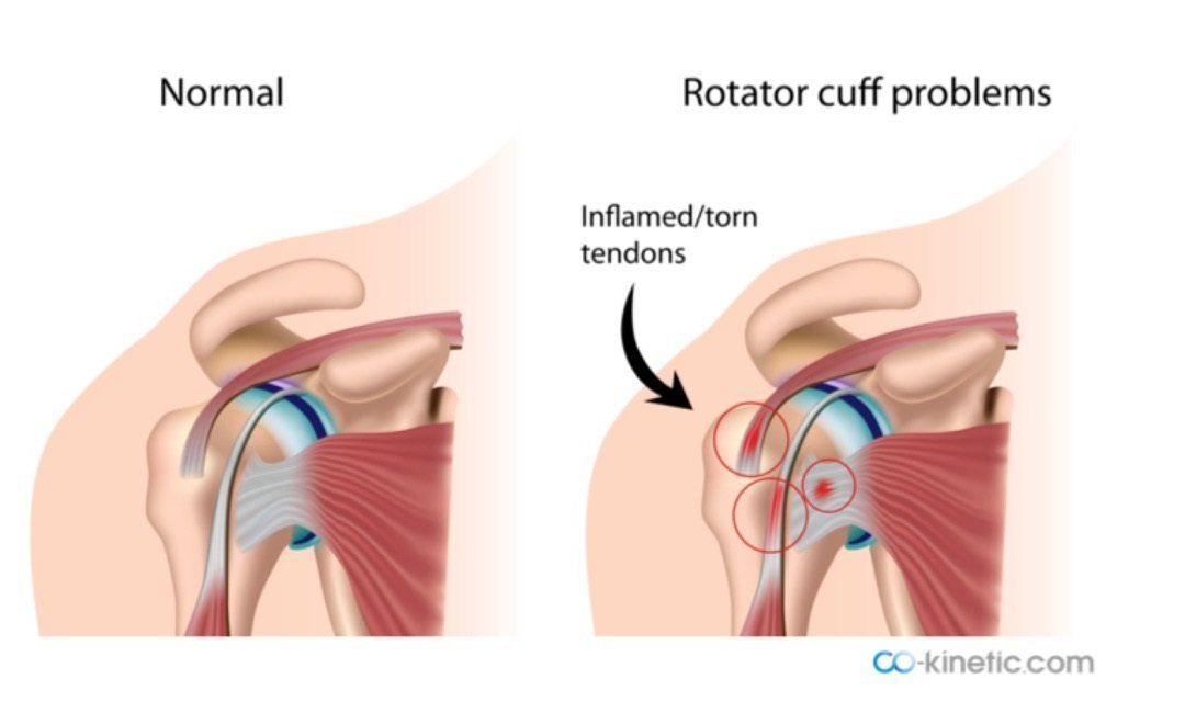 shoulder muscles anatomy 