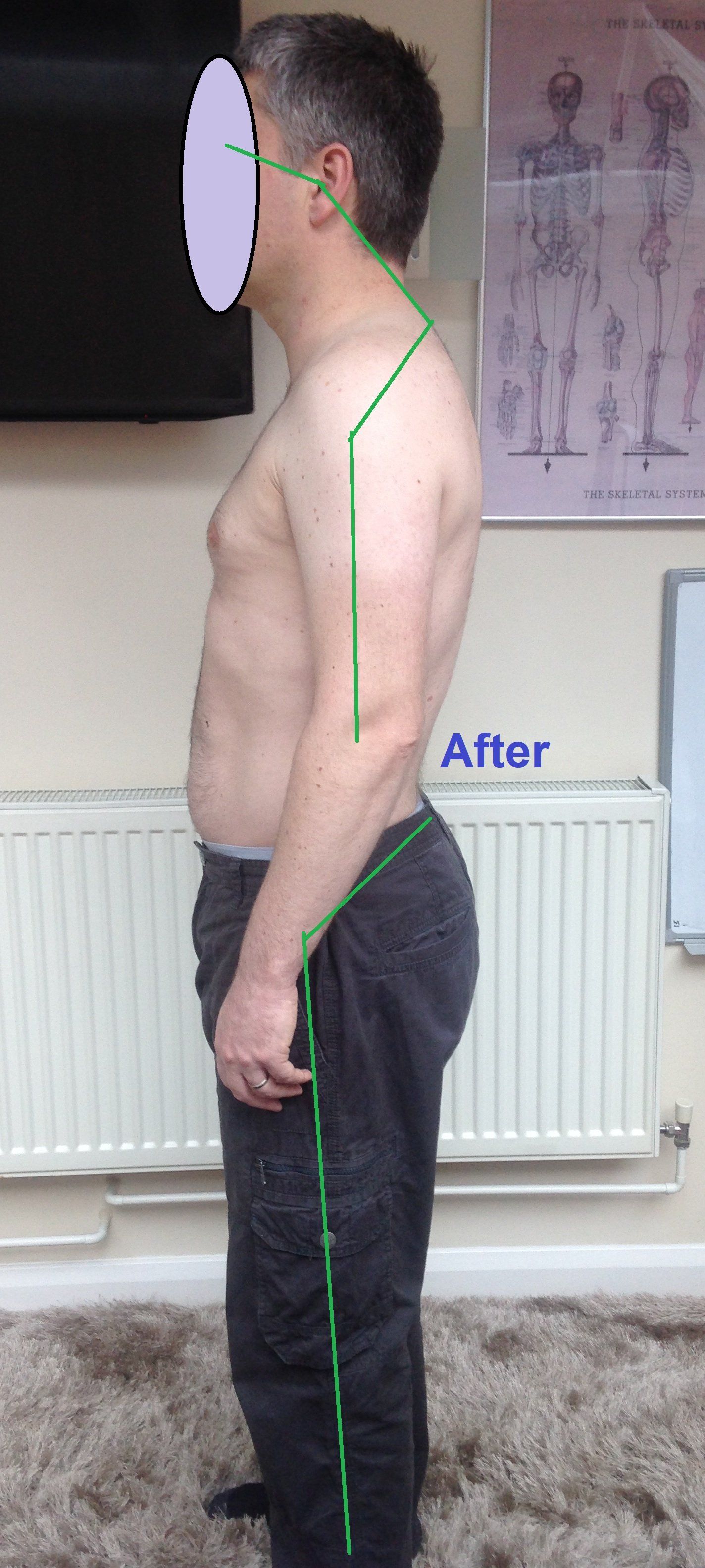 Osteopathy Posture Analysis