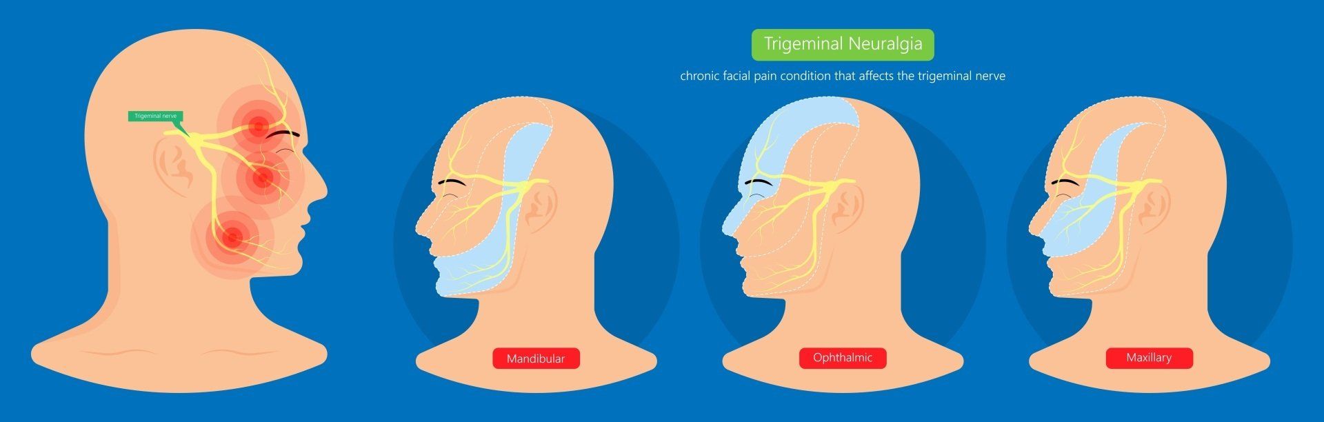 trigeminal nerve anatomy