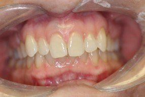 family dentistry, cosmetic dentistry, london, kentucky, ky