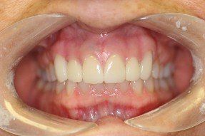 family dentistry, cosmetic dentistry, london, kentucky, ky