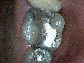 family dentistry, cosmetic dentistry, london, kentucky, ky