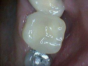 family dentistry, cosmetic dentistry, london, kentucky, ky