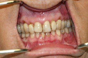 family dentistry, cosmetic dentistry, london, kentucky, ky