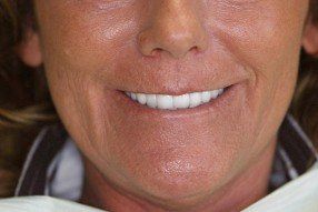 family dentistry, cosmetic dentistry, london, kentucky, ky