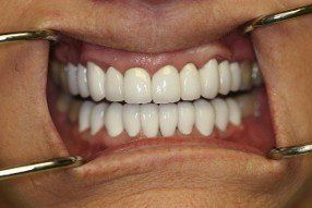family dentistry, cosmetic dentistry, london, kentucky, ky