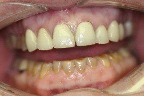 family dentistry, cosmetic dentistry, london, kentucky, ky
