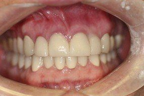 family dentistry, cosmetic dentistry, london, kentucky, ky