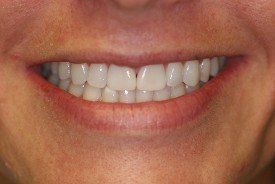 family dentistry, cosmetic dentistry, london, kentucky, ky