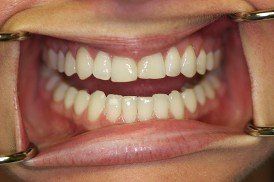 family dentistry, cosmetic dentistry, london, kentucky, ky