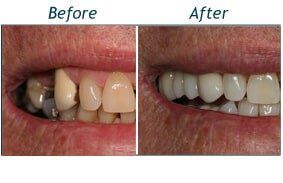 Campbell Before and After — Testimonials in Lincolntonm NC