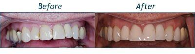 Elmore Before and After — Testimonials in Lincolntonm NC