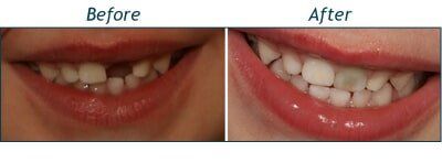 Huss Before and After — Testimonials in Lincolntonm NC