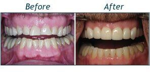 Navey Before and After — Testimonials in Lincolntonm NC