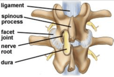 Laminotomy Laminectomy Illustration Laminotomy Laminectomy Illustration