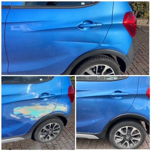Dent removal