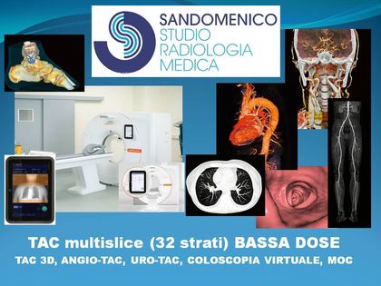 ecocolor doppler arterioso degli arti superiori ecocolor doppler arterioso degli arti superiori