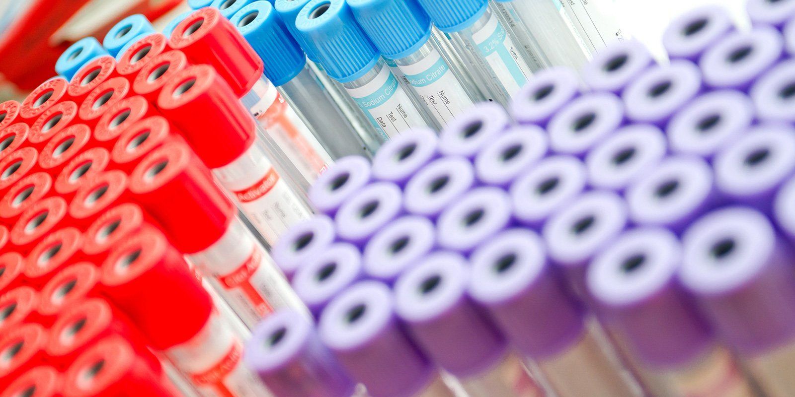 provette per esami clinici