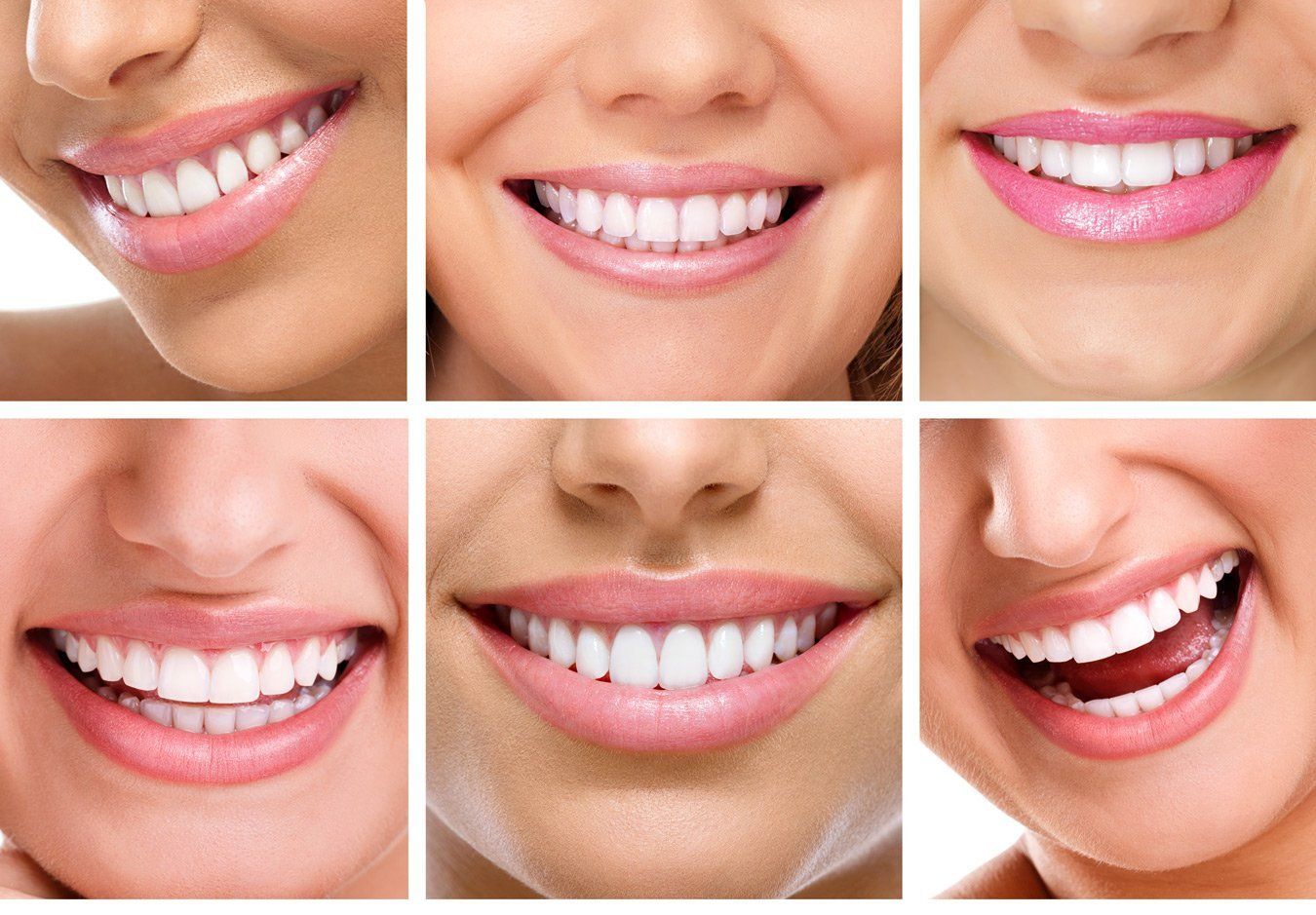 smile grid