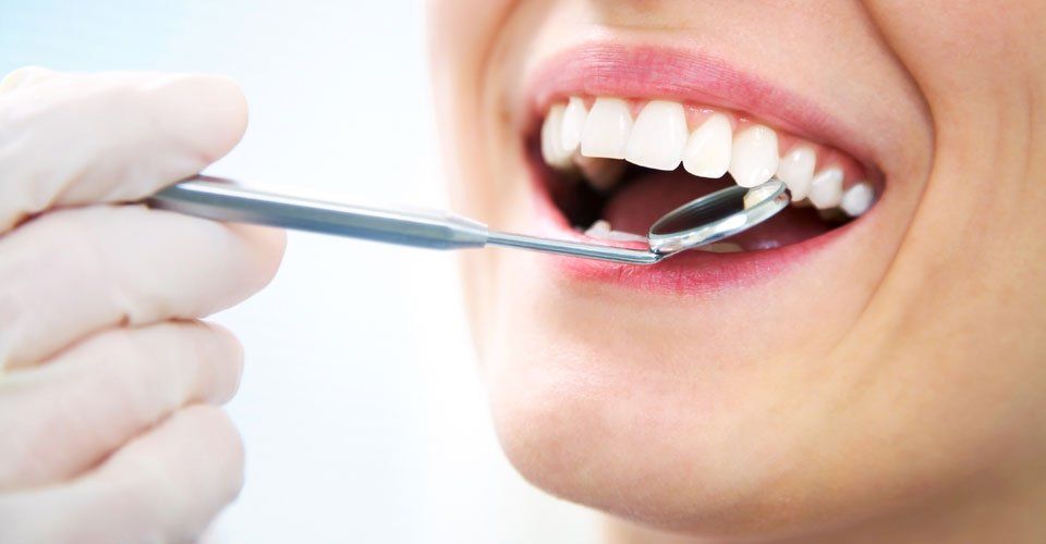 Invisible braces