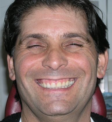 A man is smiling with his eyes closed and his mouth open.