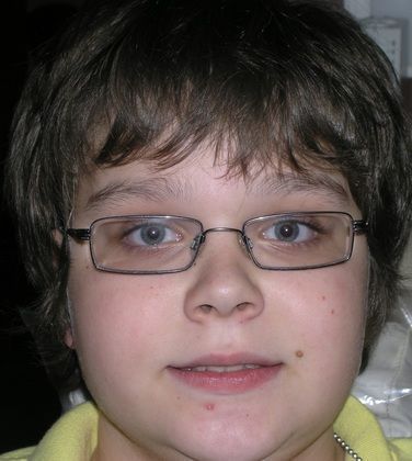 A young boy wearing glasses and a yellow shirt