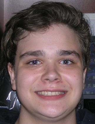 A close up of a young man 's face smiling