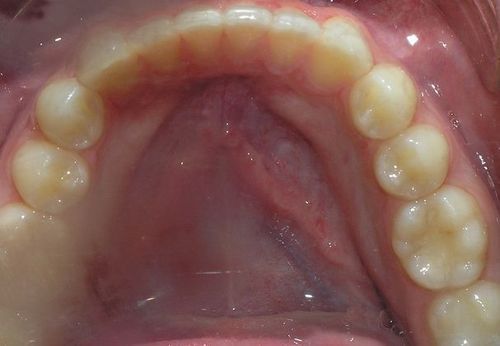 A close up of a person 's teeth and mouth.