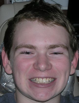 A young man is smiling with his eyes closed in a dental chair.