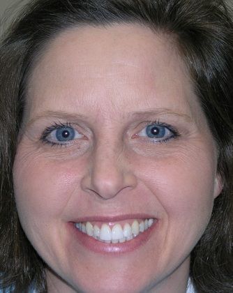 A woman with blue eyes and white teeth is smiling for the camera.
