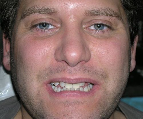 A close up of a man 's face with a smile on his face.