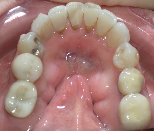A close up of a person 's mouth with a lot of teeth