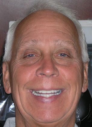 A close up of a man 's face with a smile on his face.
