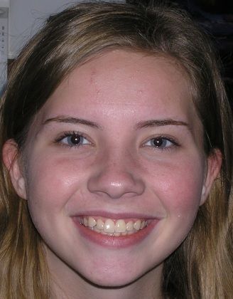 A close up of a young girl 's face smiling.