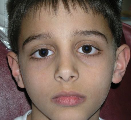 A close up of a young boy 's face with a serious look on his face
