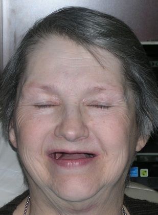 An elderly woman without teeth is smiling with her eyes closed.