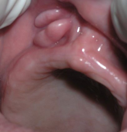 mouth