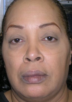 A close up of a woman 's face without makeup.