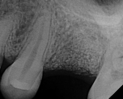 teeth