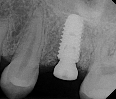 teeth